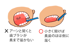 ×アーンと開くと歯ブラシが奥まで届かない。○小さく開けば奥歯のほほ側に届く