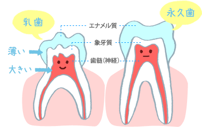 乳歯のエナメル質は薄くて弱い。
